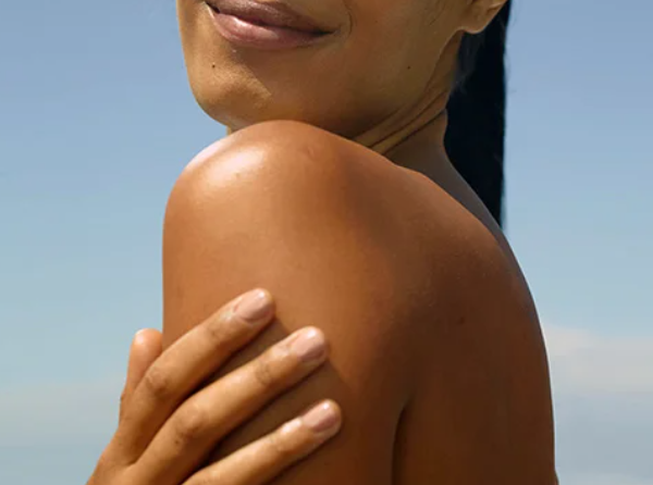 Manchas de sol: cómo prevenirlas y mejorar el tono de la piel